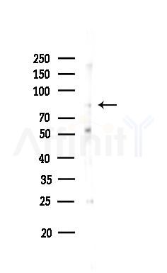 DGKA Antibody - Western blot analysis of lysates from Mouse brain, using DGKA Antibody at 1/1000 dilution.