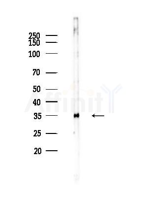 PTX3 Antibody - Western blot analysis of lysates from EC304 cells, using PTX3 Antibody at 1/1000 dilution.