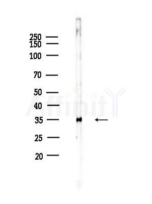 PTX3 Antibody - Western blot analysis of lysates from EC304 cells, using PTX3 Antibody at 1/1000 dilution.