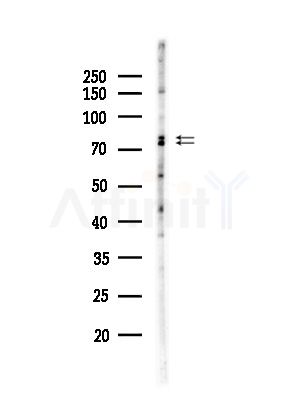 MARK3 Antibody - Western blot analysis of lysates from Hela cells(starvation,24h treatment), using MARK3 Antibody at 1/1000 dilution.