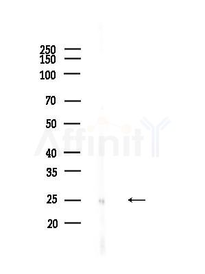 RPL10 Antibody - Western blot analysis of lysates from EC304 cells, using RPL10 Antibody at 1/1000 dilution.