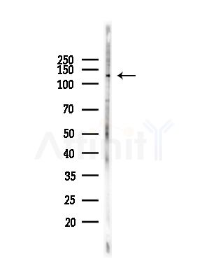 ERCC5 Antibody - Western blot analysis of lysates from COS-7 cells(heat-shock,45min treatment), using ERCC5 Antibody at 1/1000 dilution.