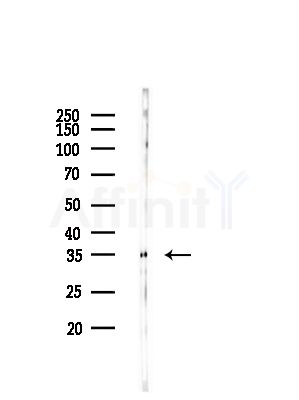 TF2E2 Antibody - Western blot analysis of lysates from Rat liver, using TF2E2 Antibody at 1/1000 dilution.