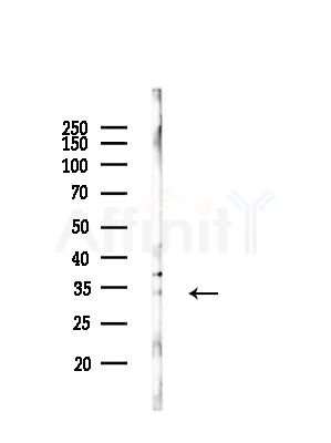 TF2E2 Antibody - Western blot analysis of lysates from Mouse lung, using TF2E2 Antibody at 1/1000 dilution.
