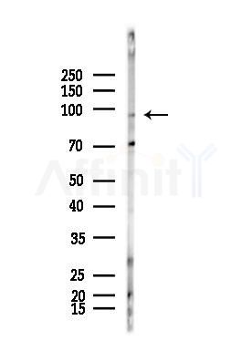 LTK Antibody - Western blot analysis of lysates from Raji cells(heat-shock,45min treatment), using LTK Antibody at 1/1000 dilution.