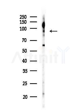 LTK Antibody - Western blot analysis of lysates from COLO205 cells(UV,30min treatment), using LTK Antibody at 1/1000 dilution.