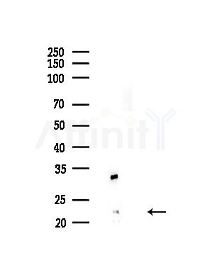 PPIF Antibody - Western blot analysis of lysates from PC12 cells(LPS,4h treatment), using PPIF Antibody at 1/1000 dilution.