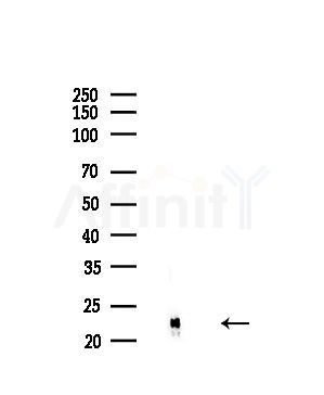 PPIF Antibody - Western blot analysis of lysates from Hela cells(starvation,24h treatment), using PPIF Antibody at 1/1000 dilution.