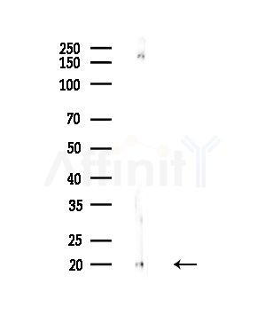 PPIF Antibody - Western blot analysis of lysates from Mouse testis, using PPIF Antibody at 1/1000 dilution.