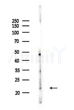 HOXA7 Antibody - Western blot analysis of lysates from MCF7 cells(heat-shock,45min treatment), using HOXA7 Antibody at 1/1000 dilution.