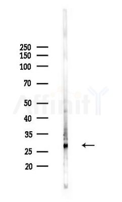 HOXA7 Antibody - Western blot analysis of lysates from Mouse liver, using HOXA7 Antibody at 1/1000 dilution.