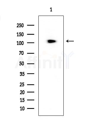 CIITA Antibody - Western blot analysis of extracts from COLO205 cells, using CIITA Antibody at 1/1000 dilution.