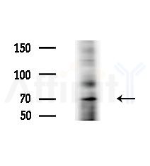 GRK5 Antibody - Western blot analysis of extracts from Hela cells(heat-shock,45min treatment), using GRK5 Antibody at 1/1000 dilution.