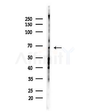 GRK5 Antibody - Western blot analysis of lysates from Hela cells(heat-shock,45min treatment), using GRK5 Antibody at 1/1000 dilution.