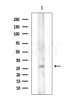 HOXD12 Antibody - Western blot analysis of extracts from 3T3-L1 cells(LPS  4h treatment), using HOXD12 Antibody at 1/1000 dilution.