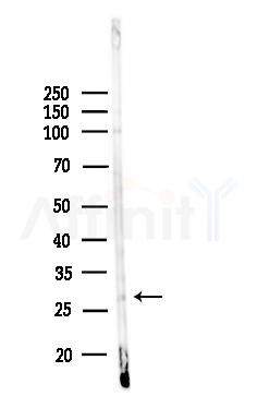 HOXD12 Antibody - Western blot analysis of lysates from 3T3-L1 P6(LPS, 4h treatment), using HOXD12 Antibody at 1/1000 dilution.