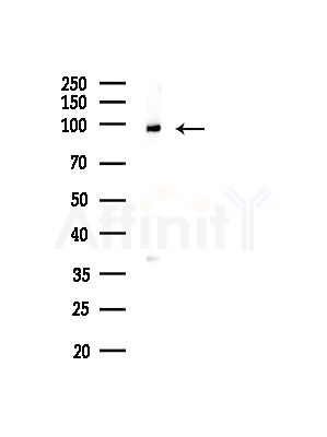 Actinin  alpha 2/3 Antibody - Western blot analysis of lysates from A375 cells(LPS, 4h treatment), using Actinin  alpha 2/3 Antibody at 1/1000 dilution.