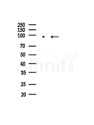 Actinin  alpha 2/3 Antibody - Western blot analysis of lysates from RAW264.