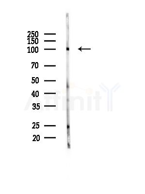 Actinin  alpha 2/3 Antibody - Western blot analysis of lysates from Rat brain, using Actinin  alpha 2/3 Antibody at 1/1000 dilution.
