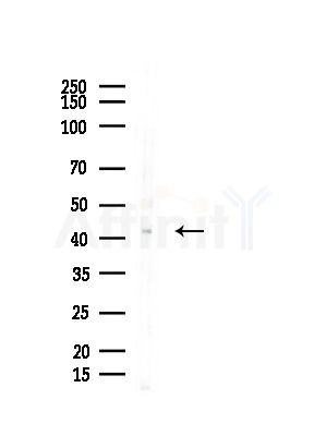 TCF7 Antibody - Western blot analysis of lysates from EC304 cells, using TCF7 Antibody at 1/1000 dilution.