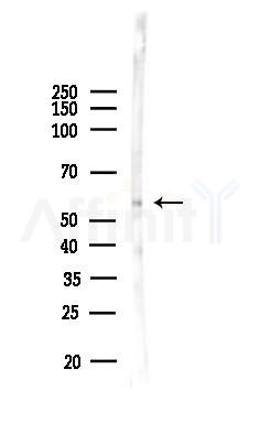 ACV1B Antibody - Western blot analysis of lysates from Mouse brain, using ACV1B Antibody at 1/1000 dilution.