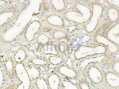 ACVL1 Antibody - DF3170 at 1/100 staining human normal kidney tissue by IHC-P.