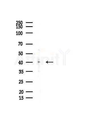 hnRNP G Antibody - Western blot analysis of lysates from EC304 cells, using hnRNP G Antibody at 1/1000 dilution.