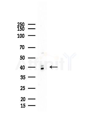 hnRNP G Antibody - Western blot analysis of lysates from COLO205 cells, using hnRNP G Antibody at 1/1000 dilution.