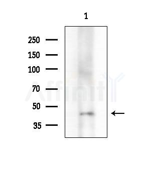 ETV6 / Tel Antibody - Western blot analysis of extracts from Mouse brain, using ETV6 / Tel Antibody at 1/1000 dilution.