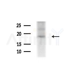 NBL1 Antibody - Western blot analysis of extracts from COLO205 cells(heat-shock,45min treatment), using NBL1 Antibody at 1/1000 dilution.