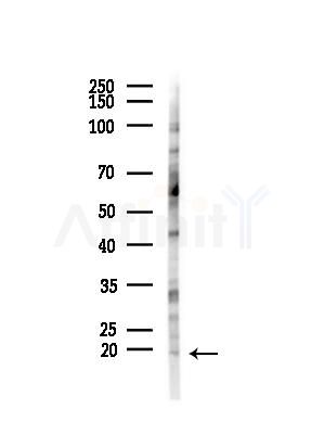 NBL1 Antibody - Western blot analysis of lysates from COLO205 cells(heat-shock,45min treatment), using NBL1 Antibody at 1/1000 dilution.