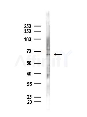 GRK6 Antibody - Western blot analysis of lysates from B16F10-LUC cells(starvation,24h treatment), using GRK6 Antibody at 1/1000 dilution.