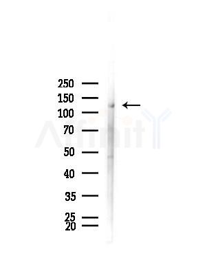 KPB1/2 Antibody - Western blot analysis of lysates from Rat brain, using KPB1/2 Antibody at 1/1000 dilution.