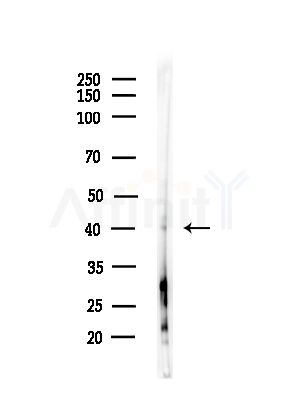 TISD Antibody - Western blot analysis of lysates from PC12 cells(starvation,24h treatment), using TISD Antibody at 1/1000 dilution.
