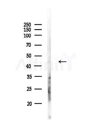 TISD Antibody - Western blot analysis of lysates from COLO205 cells(heat-shock,45min treatment), using TISD Antibody at 1/1000 dilution.