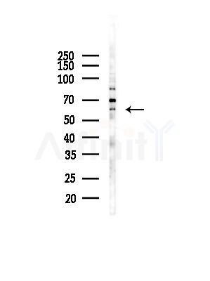 CLK2 Antibody - Western blot analysis of lysates from COLO205 cells(UV,30min treatment), using CLK2 Antibody at 1/1000 dilution.