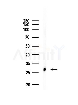 BAP31 Antibody - Western blot analysis of lysates from Raji cells(heat-shock,45min treatment), using BAP31 Antibody at 1/1000 dilution.