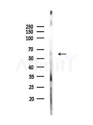 DGKE Antibody - Western blot analysis of lysates from PC12 cells, using DGKE Antibody at 1/1000 dilution.