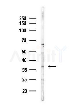 ZNF134 Antibody - Western blot analysis of lysates from Hela cells(heat-shock,45min treatment), using ZNF134 Antibody at 1/1000 dilution.