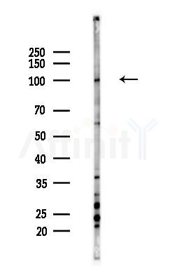 RBM5 Antibody - Western blot analysis of lysates from Hela cells(heat-shock,45min treatment), using RBM5 Antibody at 1/1000 dilution.