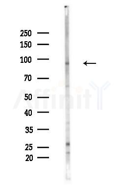 RBM5 Antibody - Western blot analysis of lysates from LoVo cells(heat-shock,45min treatment), using RBM5 Antibody at 1/1000 dilution.