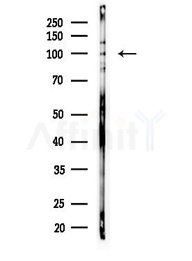 DAGK Antibody - Western blot analysis of lysates from MDA-MB-231 cells(heat-shock,45min treatment), using DAGK Antibody at 1/1000 dilution.