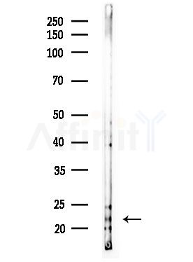 CEBPG Antibody - Western blot analysis of lysates from MDA-MB-231 cells(heat-shock,45min treatment), using CEBPG Antibody at 1/1000 dilution.