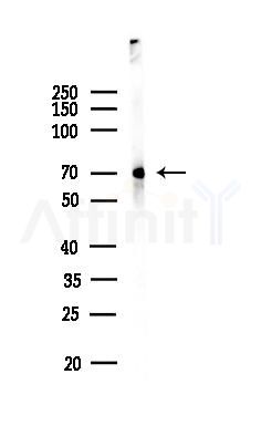 LIMK2 Antibody - Western blot analysis of lysates from Mouse brain, using LIMK2 Antibody at 1/1000 dilution.