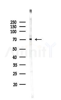 LIMK2 Antibody - Western blot analysis of lysates from 3T3-L1 P6(LPS, 4h treatment), using LIMK2 Antibody at 1/1000 dilution.