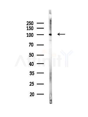 EPHB4 Antibody - Western blot analysis of lysates from Mouse brain, using EPHB4 Antibody at 1/1000 dilution.