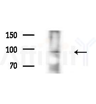 AF10 Antibody - Western blot analysis of extracts from MCF7 cells(heat-shock,45min treatment), using AF10 Antibody at 1/1000 dilution.