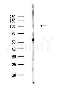 AF10 Antibody - Western blot analysis of lysates from MCF7 cells(heat-shock,45min treatment), using AF10 Antibody at 1/1000 dilution.
