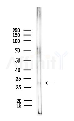 DLX5 Antibody - Western blot analysis of lysates from Rat liver, using DLX5 Antibody at 1/1000 dilution.
