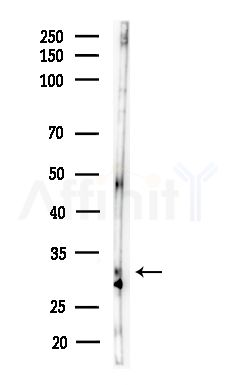 DLX5 Antibody - Western blot analysis of lysates from B16F10-LUC cells(starvation,24h treatment), using DLX5 Antibody at 1/1000 dilution.